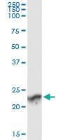 Anti-GUK1 Mouse Monoclonal Antibody [clone: 4C3-1A7]