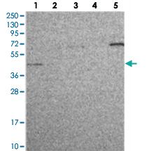 Anti-C19orf47 Rabbit Polyclonal Antibody