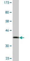 Anti-TOPORS Mouse Monoclonal Antibody [clone: 5G9]