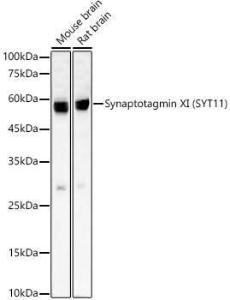 Anti-SYT11 Rabbit Monoclonal Antibody [clone: ARC59135]