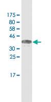 Anti-MACF1 Mouse Monoclonal Antibody [clone: 1G9]