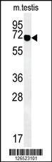 Anti-ZBTB5 Rabbit Polyclonal Antibody