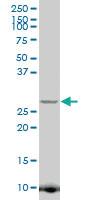 Anti-JAZF1 Mouse Polyclonal Antibody