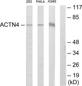 Western blot analysis of lysates from 293, HeLa, and A549 cells using Anti-ACTN1 + ACTN2 + ACTN3 + ACTN4 Antibody. The right hand lane represents a negative control, where the antibody is blocked by the immunising peptide.