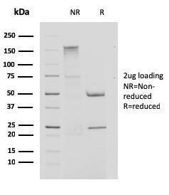 SDS-PAGE analysis of Anti-Cystatin A Antibody [CPTC-CSTA-1] under non-reduced and reduced conditions; showing intact IgG and intact heavy and light chains, respectively. SDS-PAGE analysis confirms the integrity and purity of the antibody