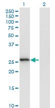 Anti-MS4A6A Mouse Monoclonal Antibody [clone: 2D12]