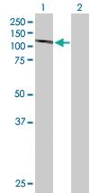 Anti-DGCR8 Rabbit Polyclonal Antibody