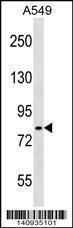 Anti-IKK, alpha/beta Rabbit Polyclonal Antibody