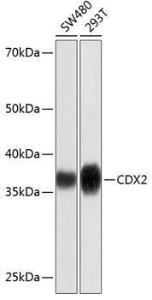 Western blot analysis of extracts of various cell lines, using Anti-CDX2 Antibody [ARC0450] (A308015) at 1:1000 dilution. The secondary Antibody was Goat Anti-Rabbit IgG H&L Antibody (HRP) at 1:10000 dilution. Lysates/proteins were present at 25 µg per lane