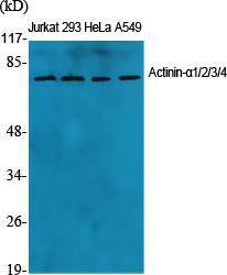 Western blot analysis of various cells using Anti-ACTN1 + ACTN2 + ACTN3 + ACTN4 Antibody