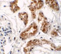 Anti-ZNF346 Rabbit Polyclonal Antibody