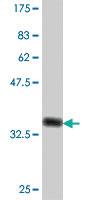 Anti-TP53BP2 Mouse Polyclonal Antibody