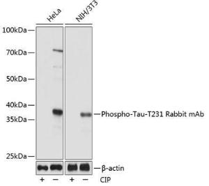 Anti-Tau (phospho Thr231) Rabbit Monoclonal Antibody [clone: ARC0021]