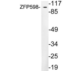 Anti-ZFP598 antibody