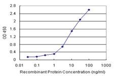 Anti-TIPIN Polyclonal Antibody Pair