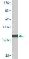 Anti-TOPORS Mouse Monoclonal Antibody [clone: 6D2]