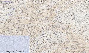 Immunohistochemical analysis of paraffin-embedded human uterus tissue using Anti-SirT1 Antibody at 1:200 (4°C overnight). Negative control was secondary antibody only.