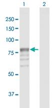 Anti-GUSB Rabbit Polyclonal Antibody