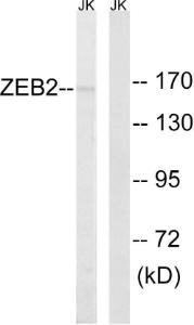 Western blot analysis of lysates from Jurkat cells using Anti-ZEB2 Antibody. The right hand lane represents a negative control, where the antibody is blocked by the immunising peptide