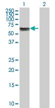 Anti-ASNS Rabbit Polyclonal Antibody