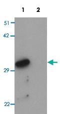 Anti-ZNF346 Rabbit Polyclonal Antibody