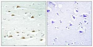 Immunohistochemical analysis of paraffin-embedded human brain using Anti-ACTN1 + ACTN2 + ACTN3 + ACTN4 Antibody 1:100 (4°C overnight). The right hand panel represents a negative control, where the antibody was pre-incubated with the immunising peptide.