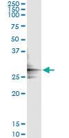 Anti-GLUD2 Antibody Pair