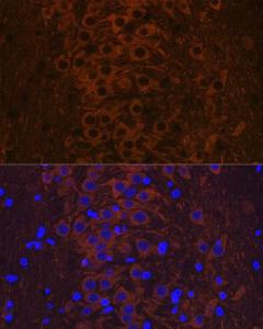 Anti-Tau (phospho Thr231) Rabbit Monoclonal Antibody [clone: ARC0021]