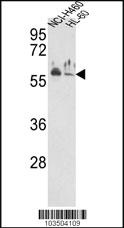 Anti-NPPC Rabbit Polyclonal Antibody [clone: 365CT24.1.1]