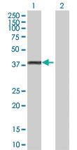 Anti-GYG1 Rabbit Polyclonal Antibody