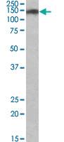 Anti-SMC2 Goat Polyclonal Antibody