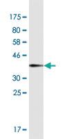 Anti-DAAM2 Mouse Monoclonal Antibody [clone: 1D8]