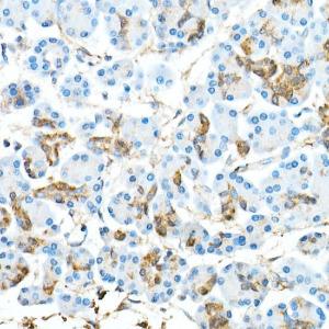 Immunohistochemistry analysis of paraffin-embedded human pancreas using Anti-CDX2 Antibody [ARC0450] (A308015) at a dilution of 1:300 (40X lens). Perform microwave antigen retrieval with 10 mM PBS buffer pH 7.2 before commencing with IHC staining protocol