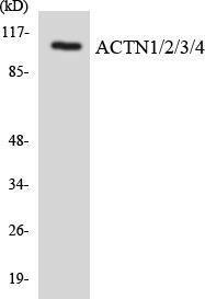 Western blot analysis of the lysates from COLO205 cells using Anti-ACTN1 + ACTN2 + ACTN3 + ACTN4 Antibody