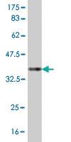 Anti-TP53BP2 Mouse Monoclonal Antibody [clone: 3F8]