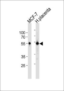 Anti-ESR2 Rabbit Polyclonal Antibody (AP (Alkaline Phosphatase))