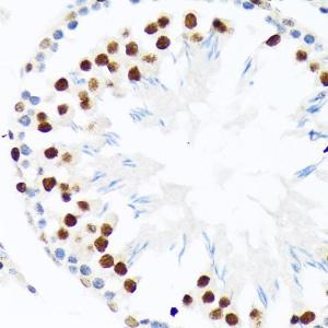 Immunohistochemistry analysis of paraffin-embedded rat testis using Anti-PIAS1 + PIAS2 Antibody [ARC1690] (A305609) at a dilution of 1:100 (40x lens)