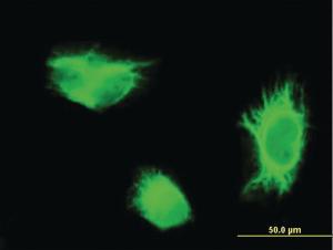 Anti-IL15 Mouse Monoclonal Antibody [clone: 1A5]