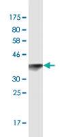 Anti-TOPORS Mouse Monoclonal Antibody [clone: 6D2]