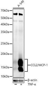 Anti-MCP1 antibody