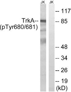 Anti-TrkA + TrkB + TrkC Rabbit Polyclonal Antibody