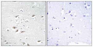 Immunohistochemical analysis of paraffin-embedded human brain tissue using Anti-ZEB2 Antibody. The right hand panel represents a negative control, where the antibody was pre-incubated with the immunising peptide