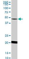 Anti-NADK Mouse Monoclonal Antibody [clone: 5F4]