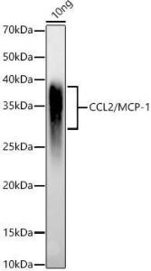 Anti-MCP1 antibody