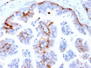 Immunohistochemical analysis of formalin-fixed, paraffin-embedded human prostate using Anti-Cystatin A Antibody [CSTA/2882]