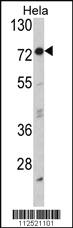 Anti-HRI (EIF2AK1) Rabbit Polyclonal Antibody