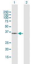 Anti-QPRT Rabbit Polyclonal Antibody