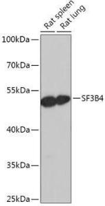 Western blot analysis of extracts of various cell lines, using Anti-SF3B4 Antibody (A306795) at 1:1,000 dilution. The secondary antibody was Goat Anti-Rabbit IgG H&L Antibody (HRP) at 1:10,000 dilution.