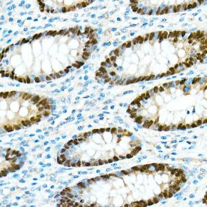 Immunohistochemistry analysis of paraffin-embedded human appendix tissue using Anti-CDX2 Antibody [ARC0450] (A308015) at a dilution of 1:300 (40X lens). Perform microwave antigen retrieval with 10 mM PBS buffer pH 7.2 before commencing with IHC staining protocol