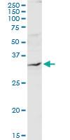 Anti-QPRT Rabbit Polyclonal Antibody